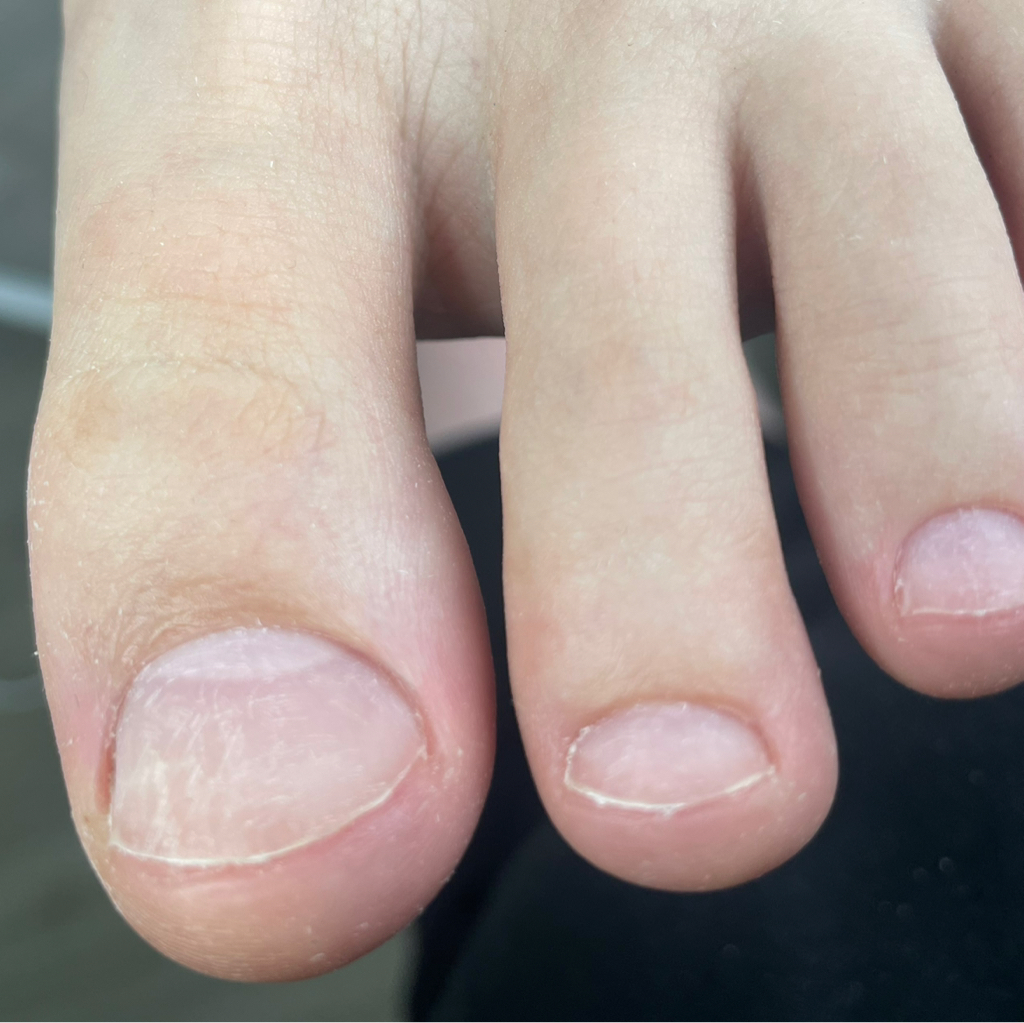 Снятие покрытия + педикюр Mini (обработка пальчиков)