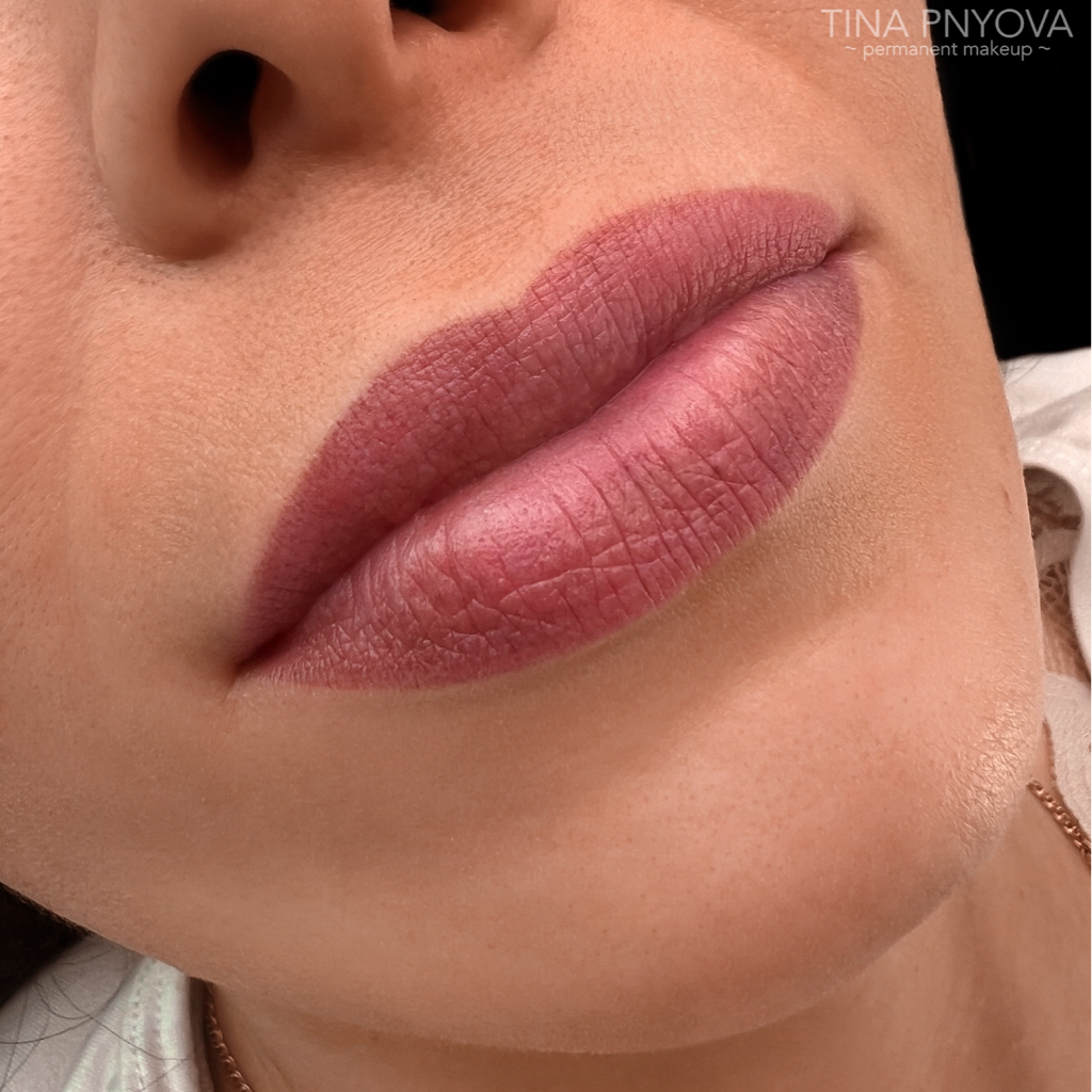 Коррекция ПМ губ