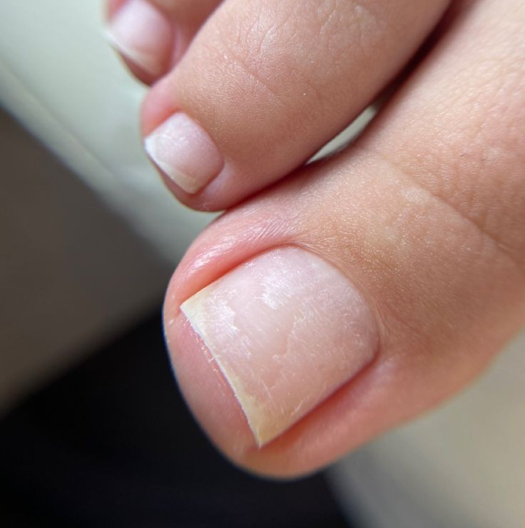 Педикюр (обработка пальчиков без покрытия)