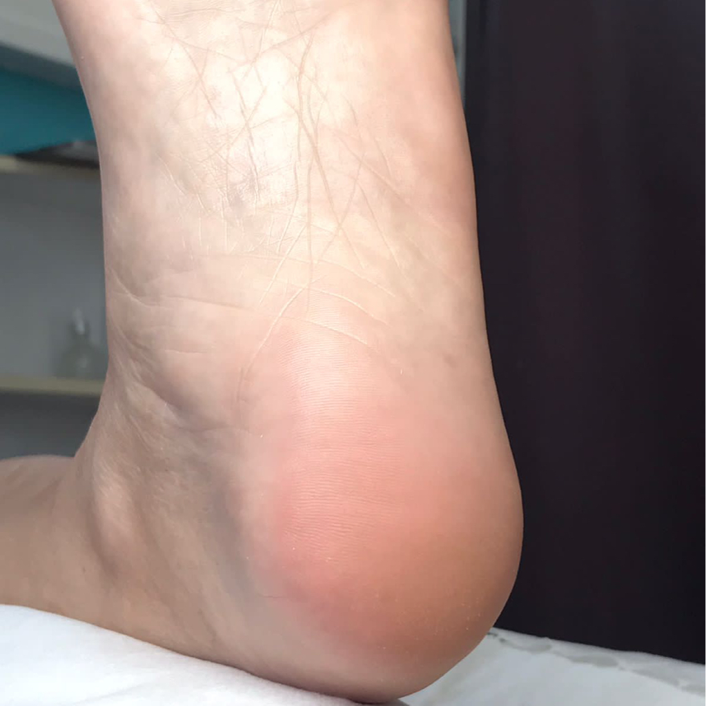 Педикюр (полная обработка пяток и пальцев без дальнейшего покрытия)