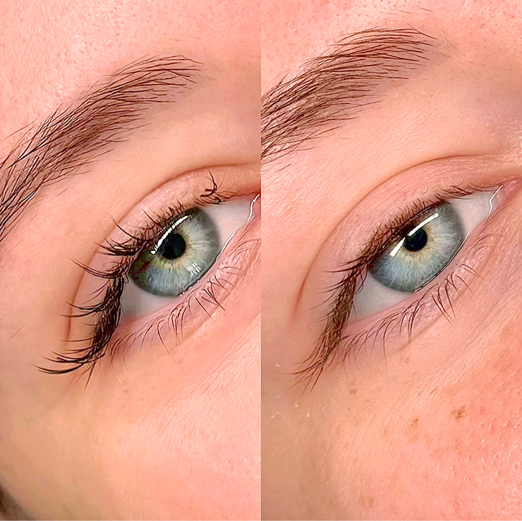 Снятие наращенных ресниц