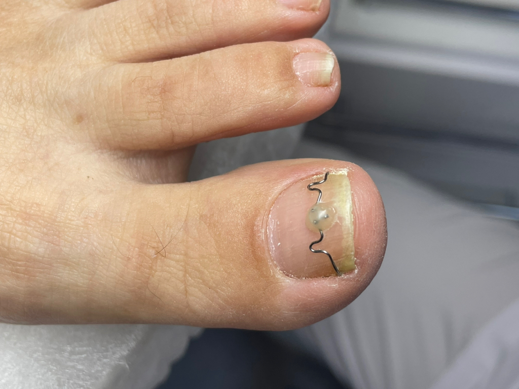 Переустановка к/с