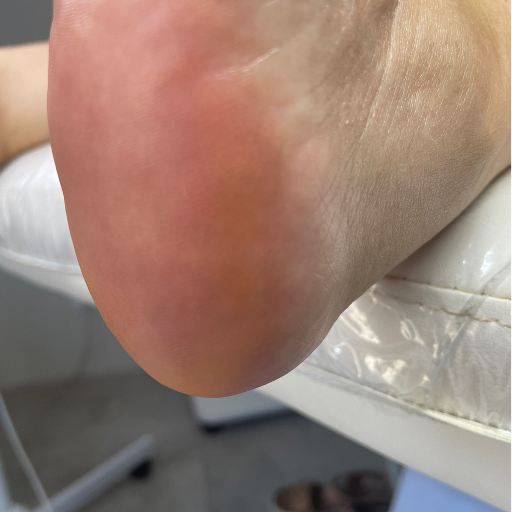 Гигиенический педикюр без покрытия 1/2 (здоровые стопы ИЛИ ногти)