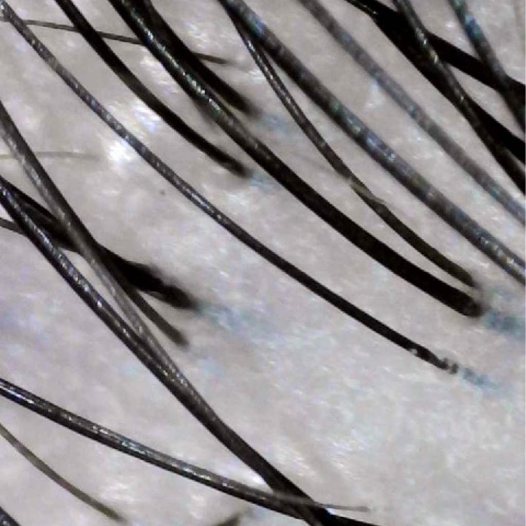 Трихологический комплекс