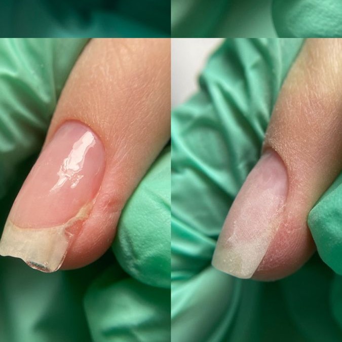 ремонт/ наращивание 1 ноготь