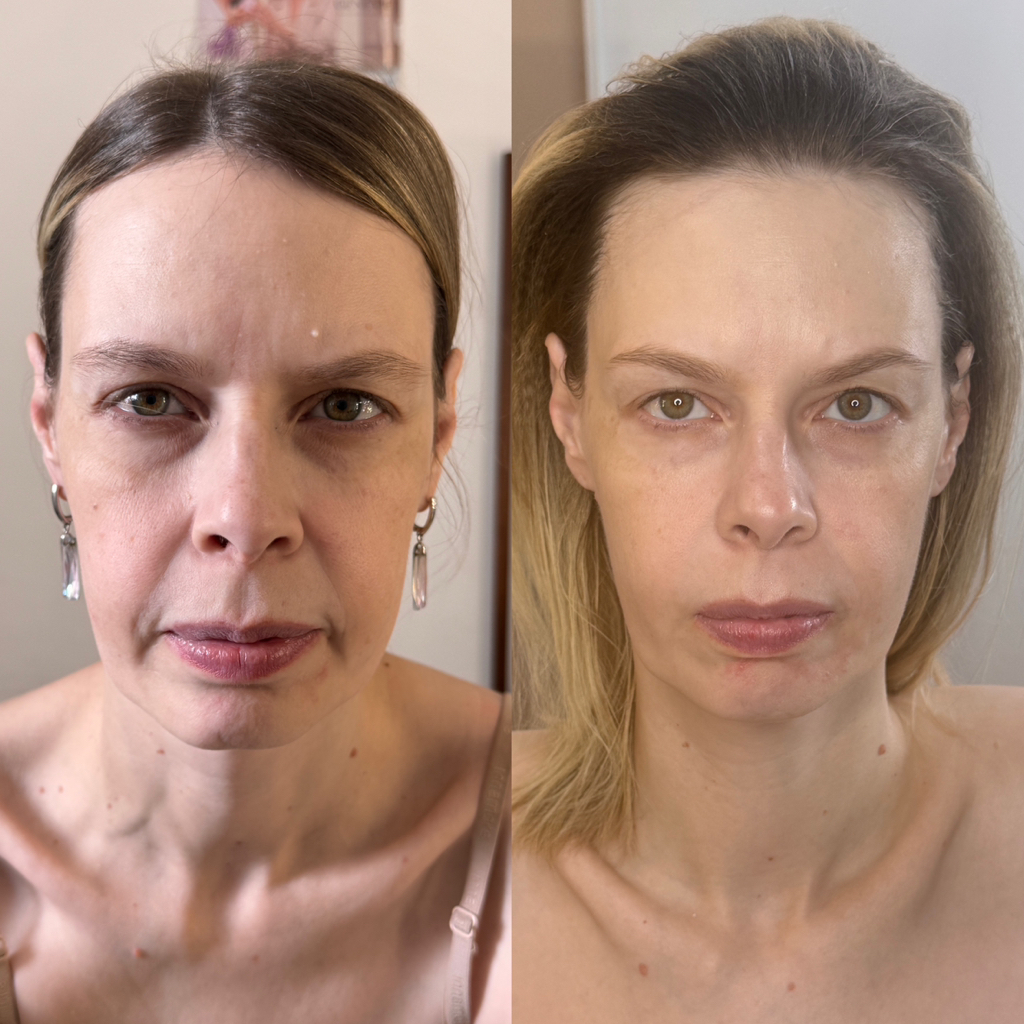 Массаж лица+пилинг