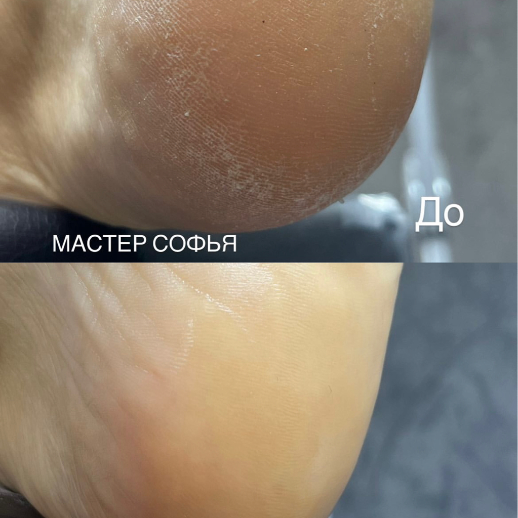 Smart-педикюр только пяточки