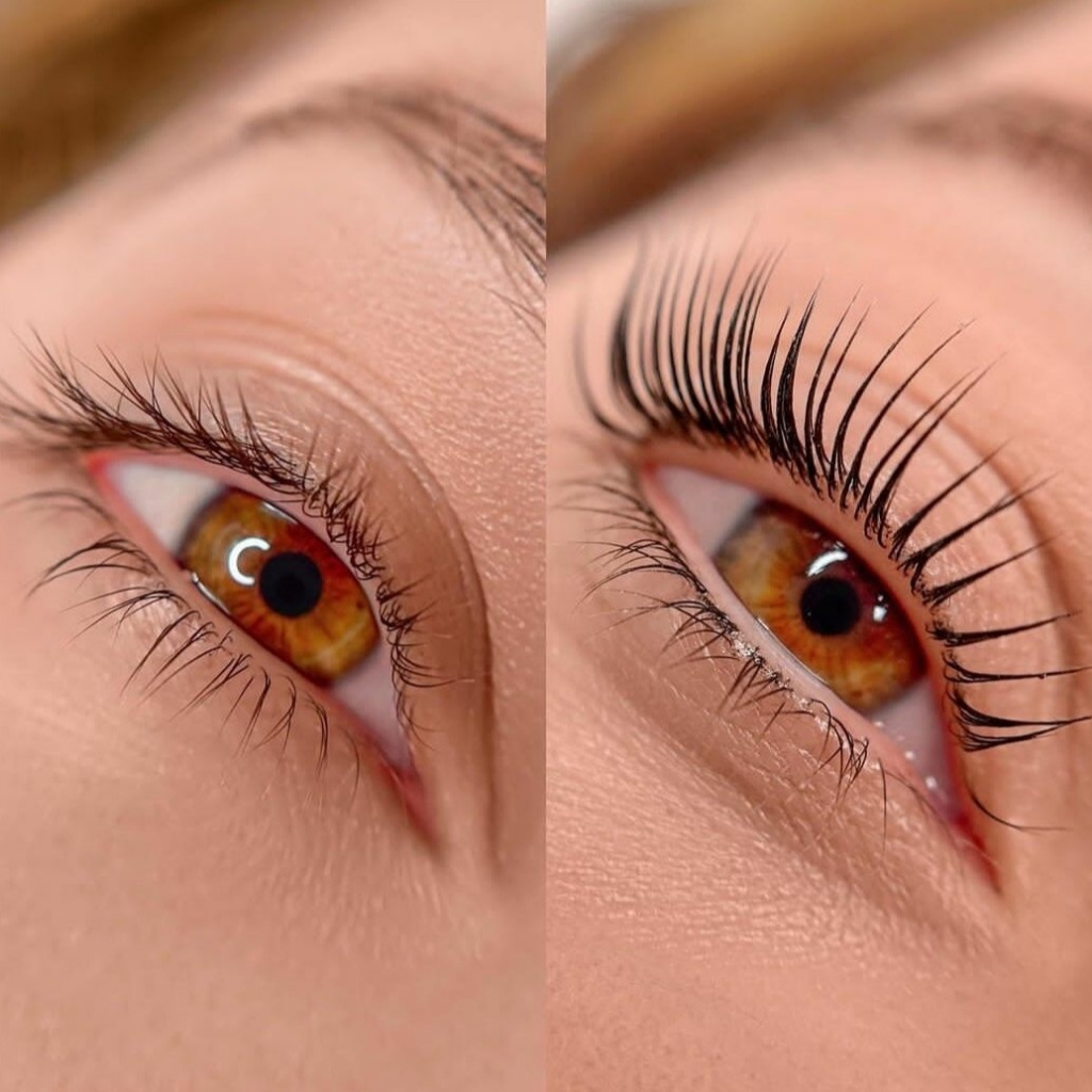 Ботокс ресниц