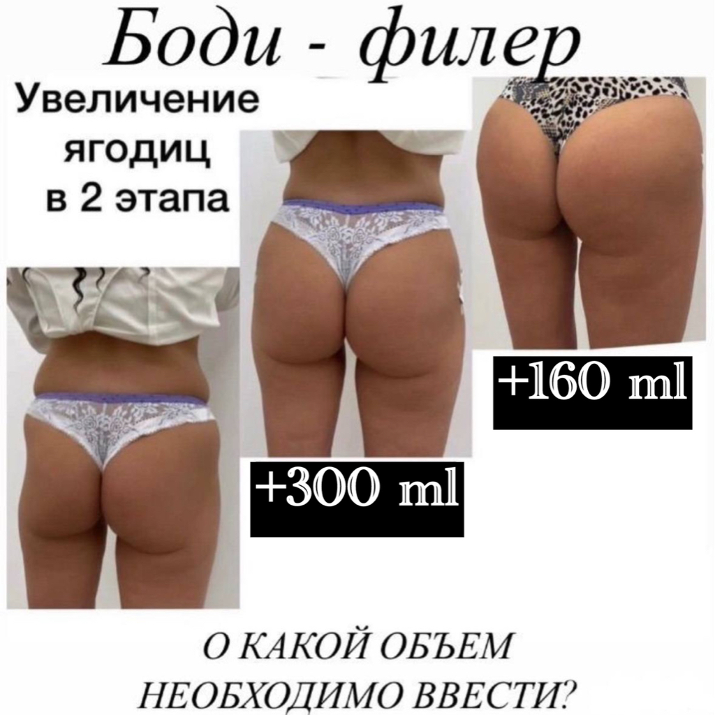 Увеличение ягодиц