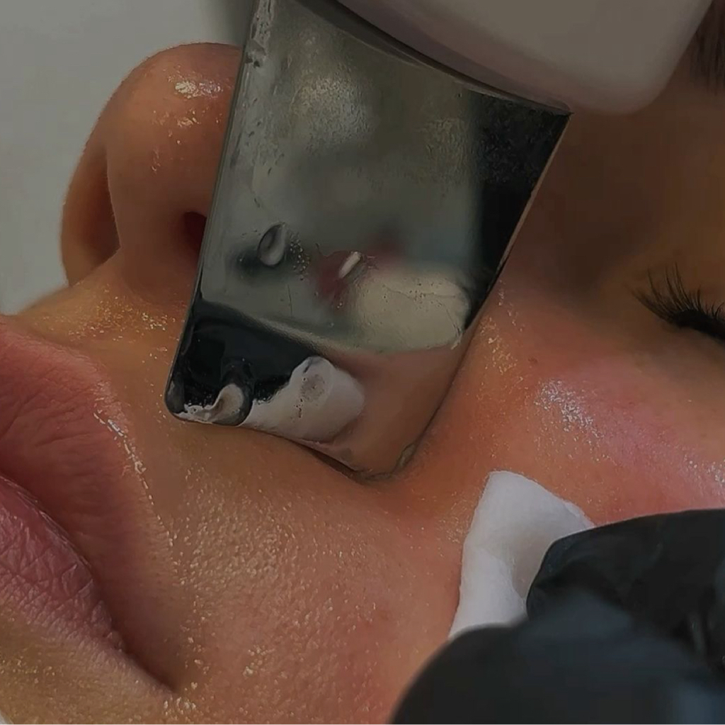 Ультразвуковая чистка лица - сияющая кожа без боли и уколов.