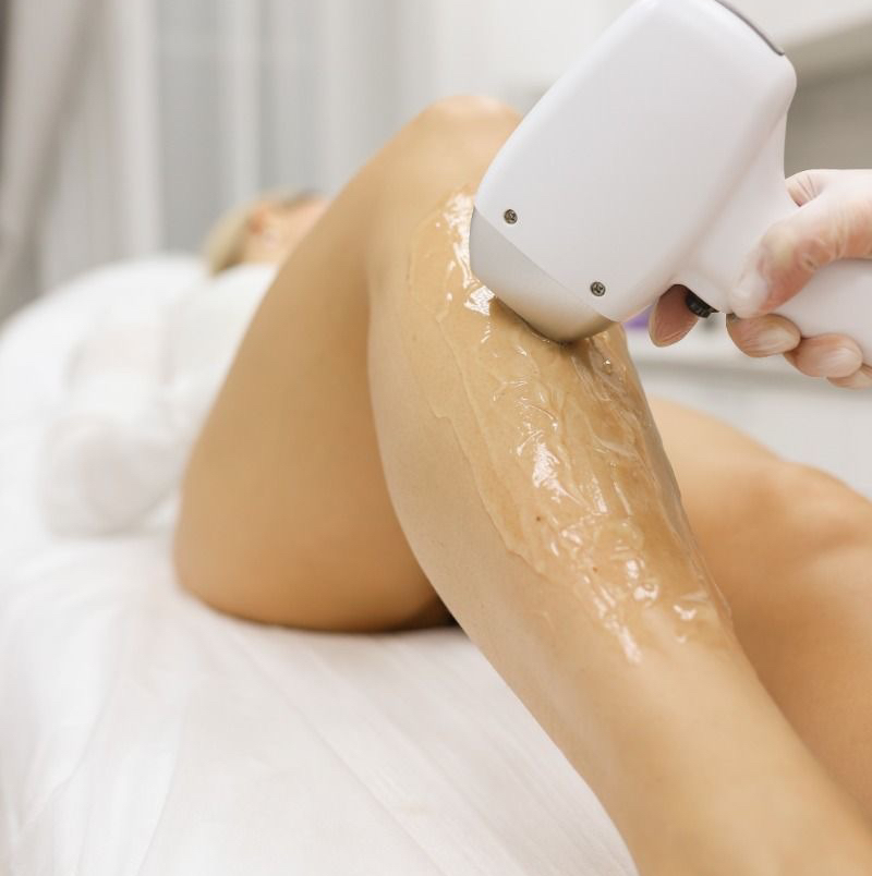 Лазерная эпиляция-Голени