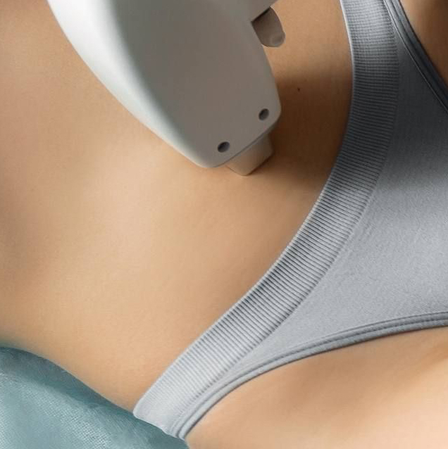 Лазерная эпиляция-Классическое бикини