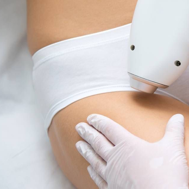 Лазерная эпиляция-Глубокое бикини