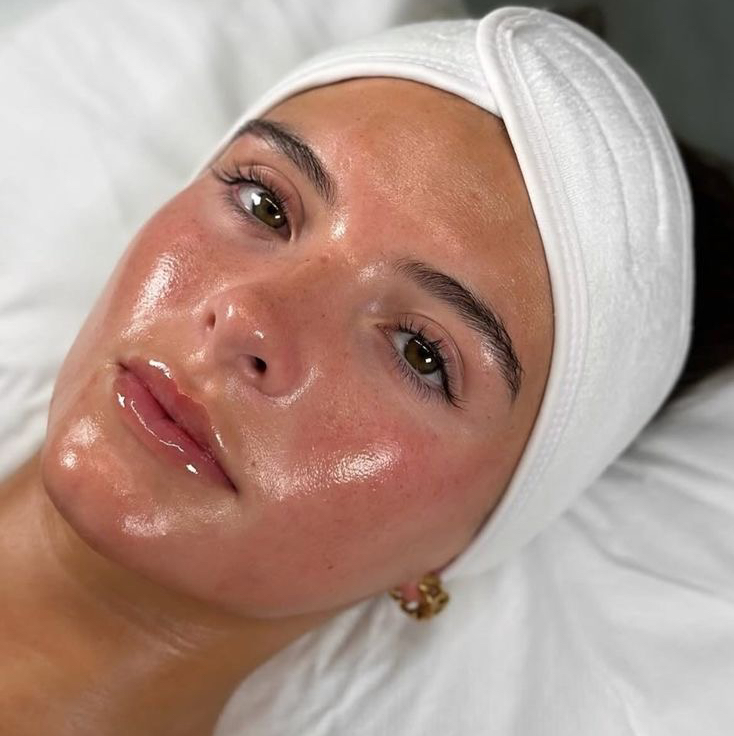 Пилинг для проблемной кожи лица /Peel for Couperose skin