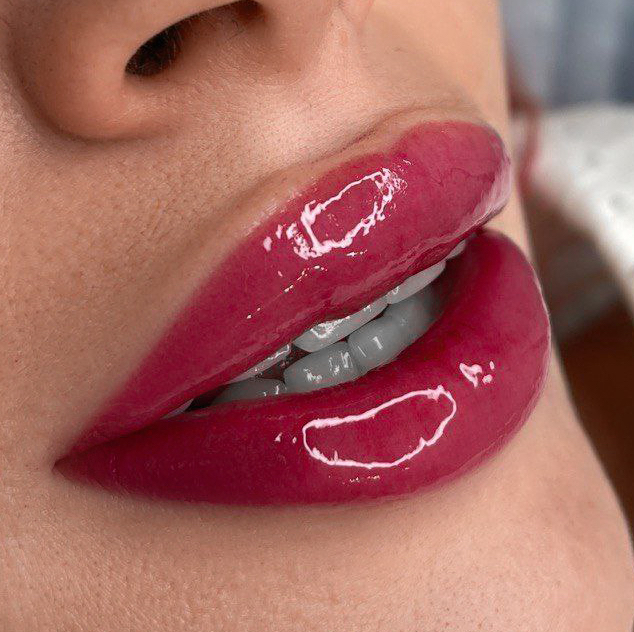 ПМ губ коррекция