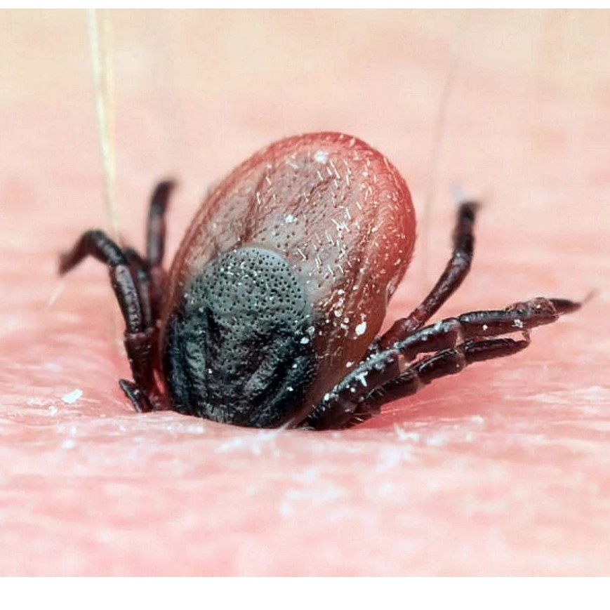 Снятие клеща