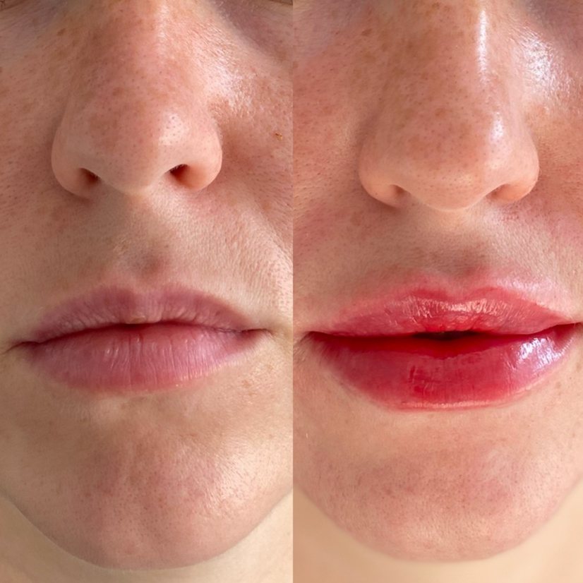 3.УВЕЛИЧЕНИЕ•ГУБ 👄