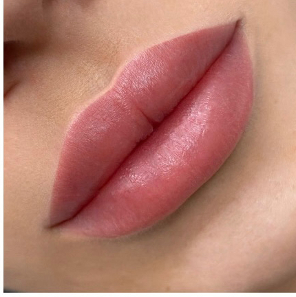 Увлажнение губ (биоревитализация)