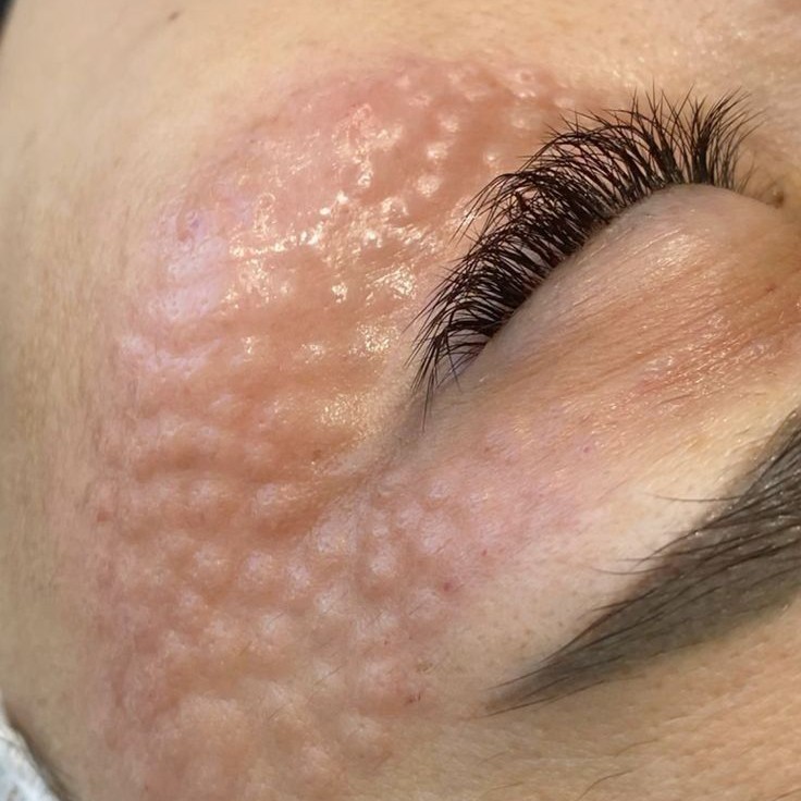 Реви ЕУЕ 1 мл(вокруг глаз)