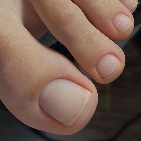 Обработка пальчиков на ногах без покрытия