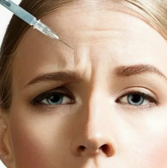 БОТУЛОТОКСИН 
Межбровье/Лоб