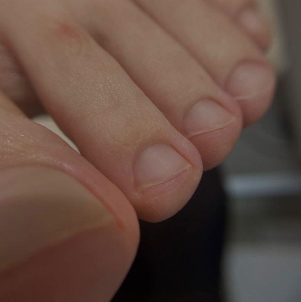 Мужской педикюр