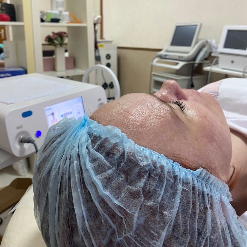 Индиба Лицо 💫