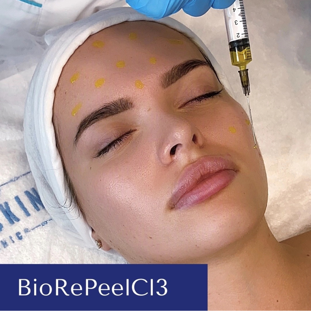 BioRePeel пилинг (Лицо+шея)