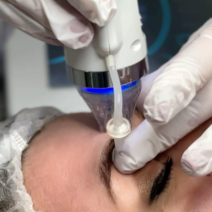 Лифтинг -RF+кислородная кисть (глубокое введение сывороток и витаминов по типу кожи )+лёд маска(светодиодная)