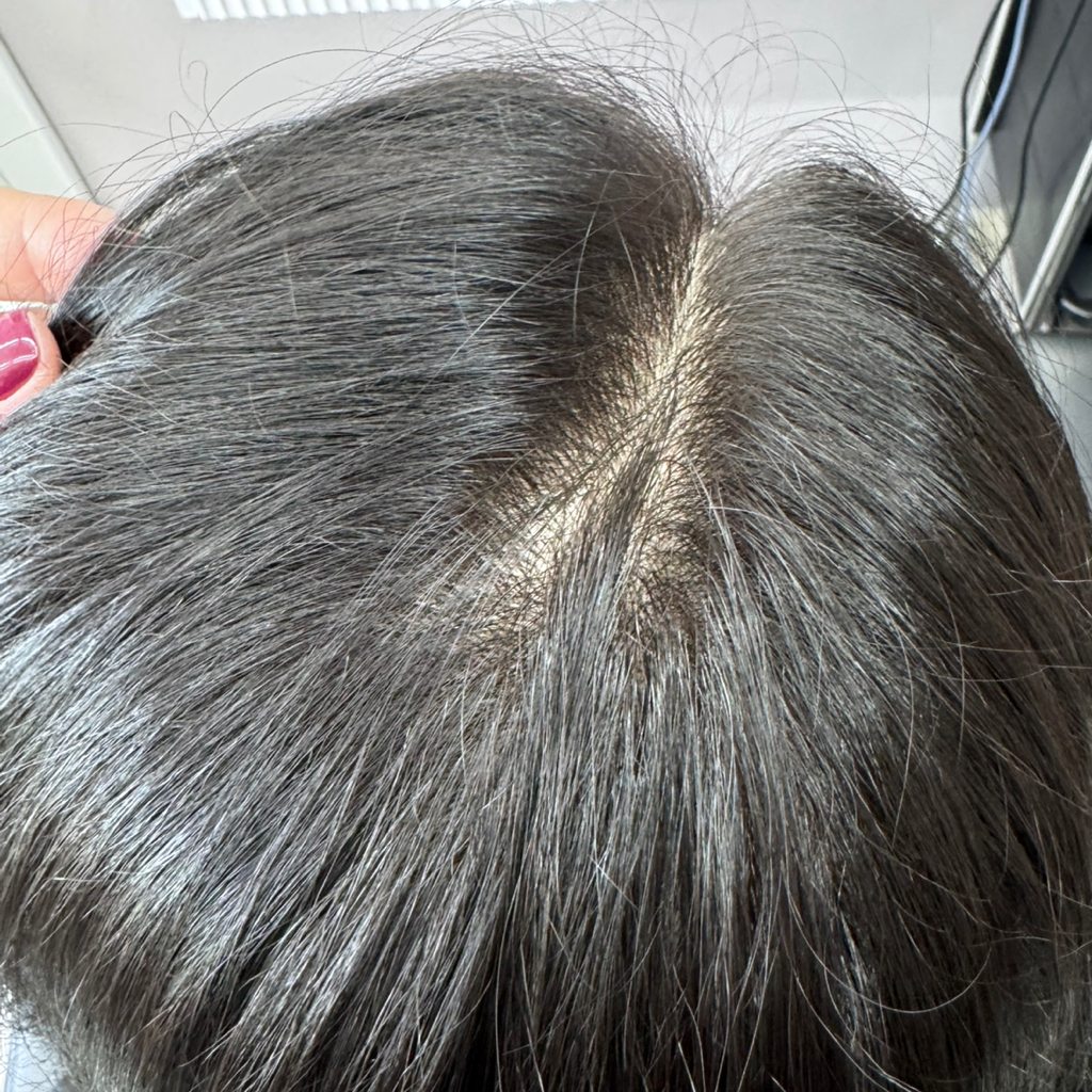 Окрашивание Корней