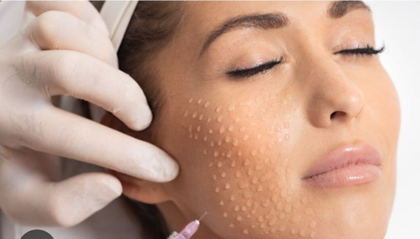 Биоревитализация