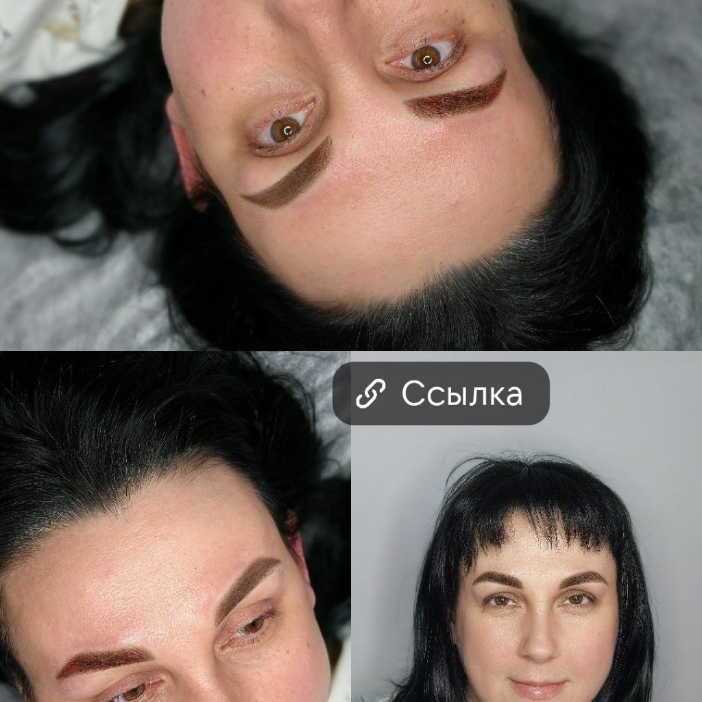 Рефреш-Обновление ПМ через полгода-год после первоначальной процедуры