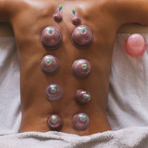 Вакуумные банки