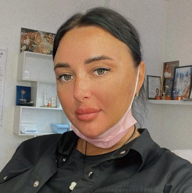 Консультация косметолога эстетиста