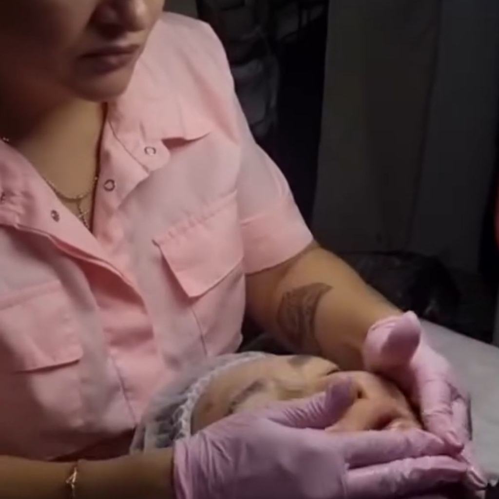 Консультация косметолога