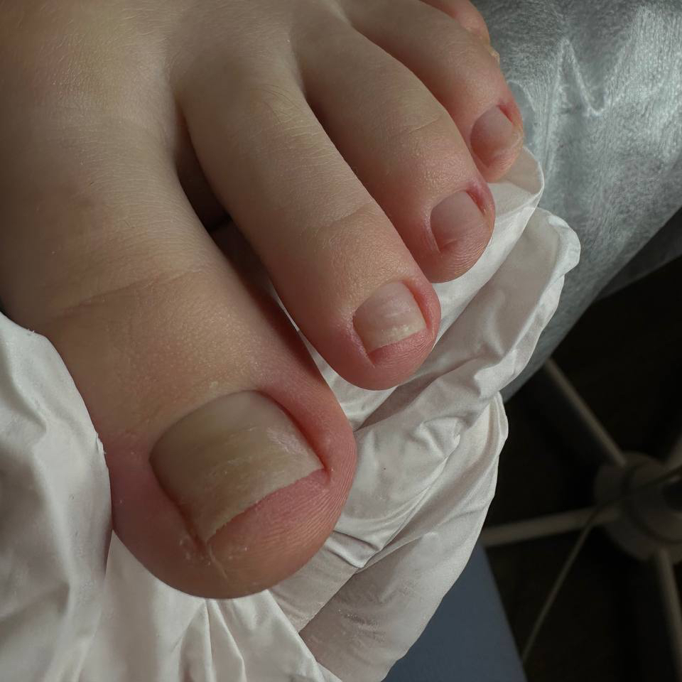 Педикюр. Обработка пальчиков