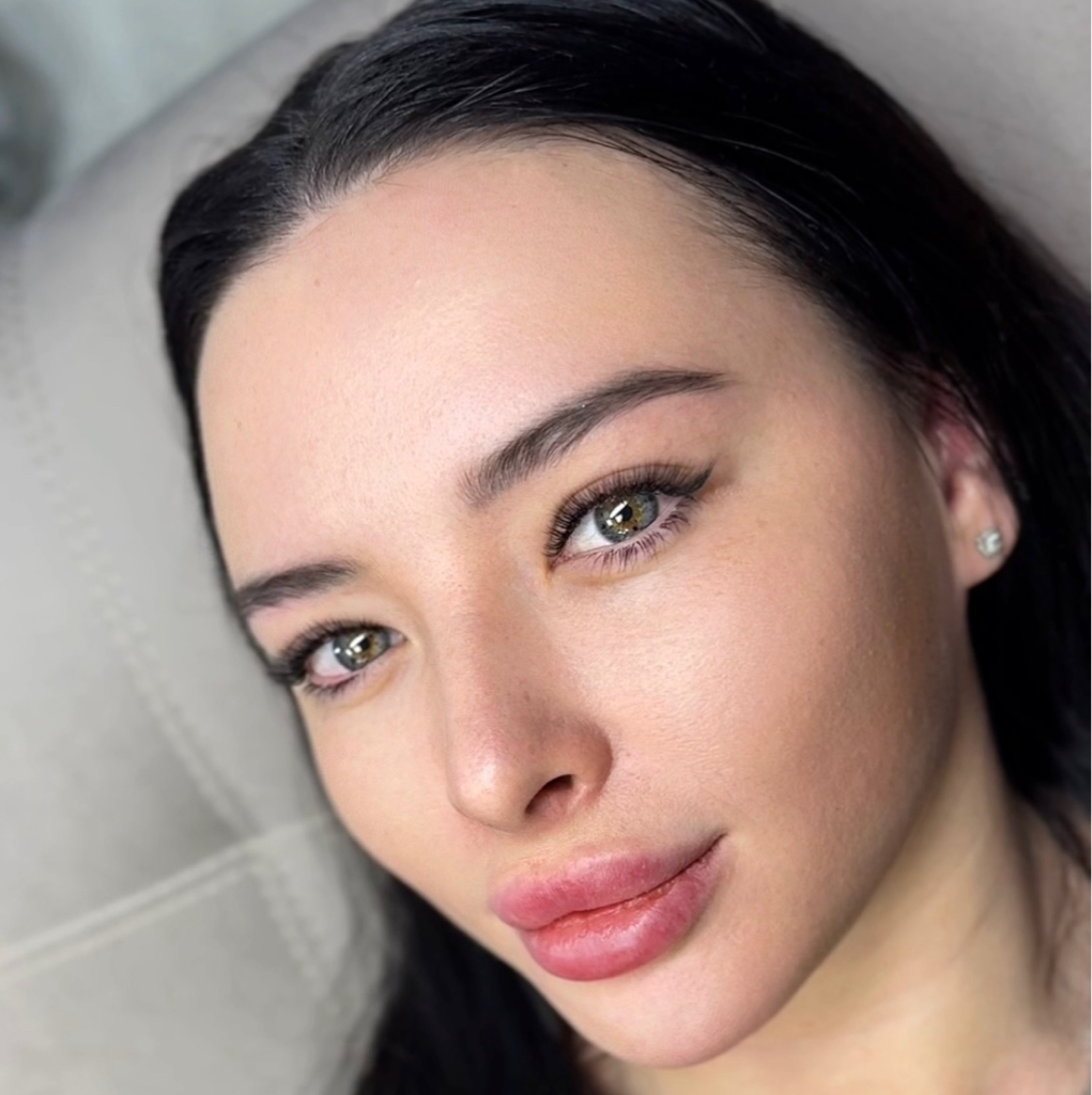 Наращивание 2 D