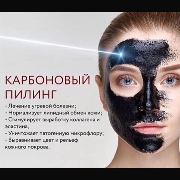 Карбоновый пилинг