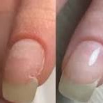 Ремонт ногтя