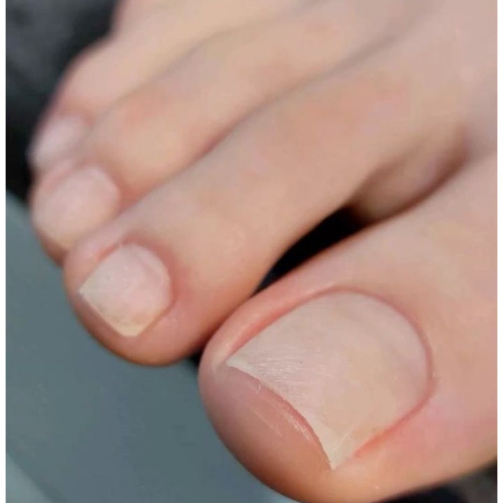 педикюр (гигиена)пальчики без покрытия