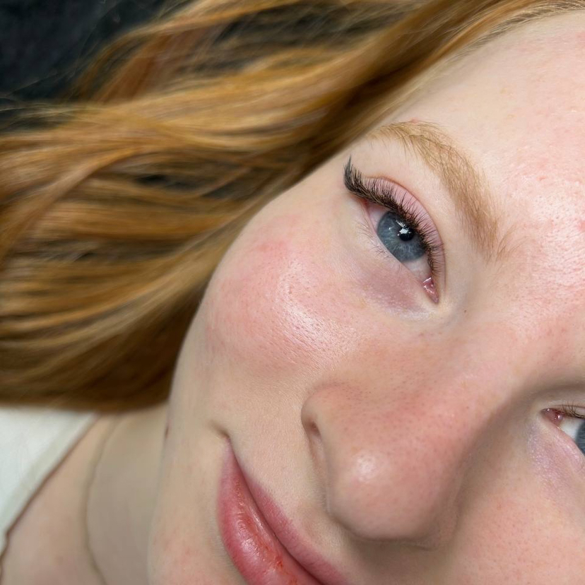 LED-наращивание 1,5D