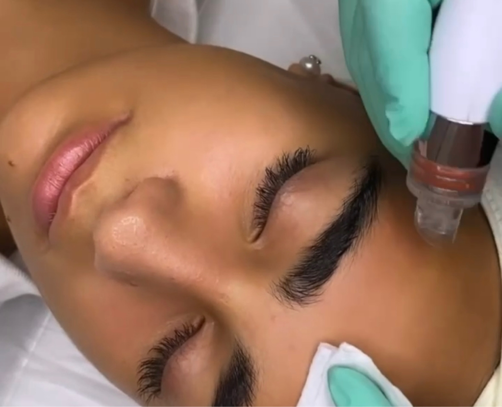 Процедура «ОБНОВЛЕНИЕ»