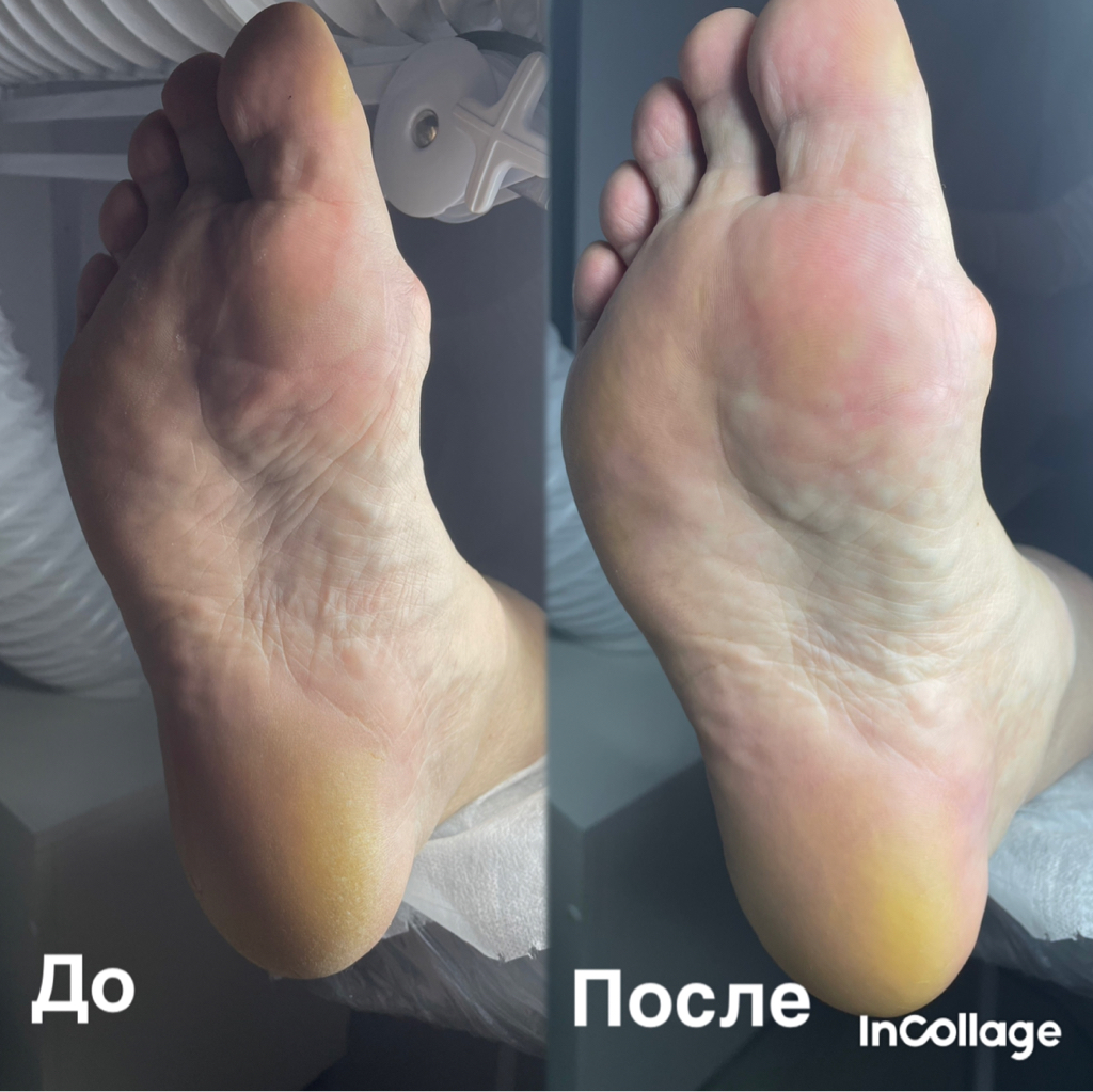 Аппаратный педикюр без покрытия (стопы,пальцы)