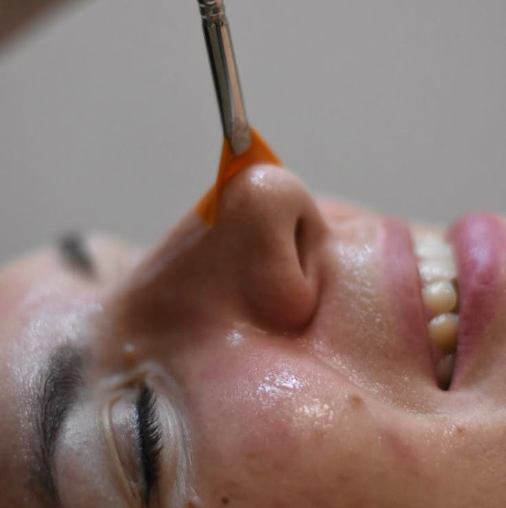 Атравматичная чистка лица на препаратах GiGi