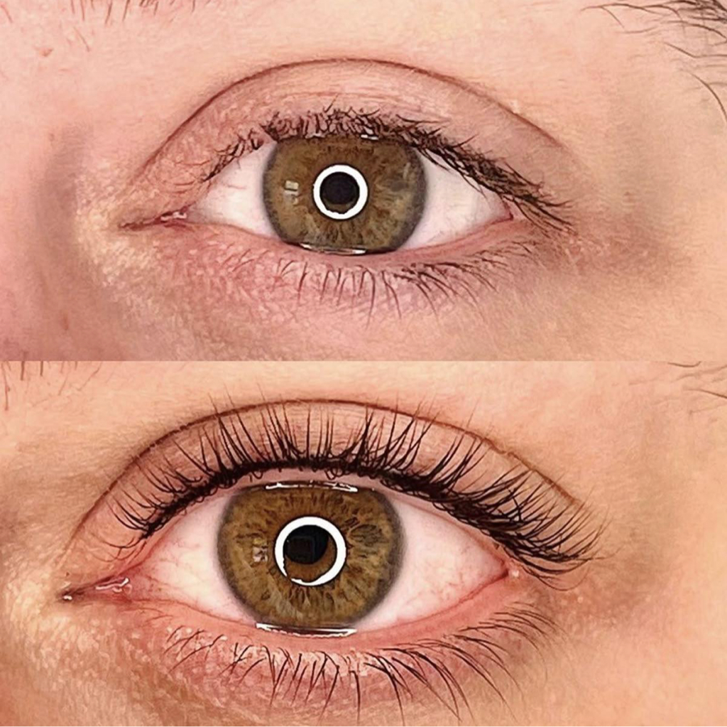 Перманент межресничка