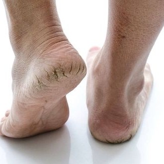 8105 комплексная обработка 3 степень