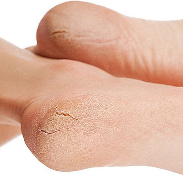 8104 комплексная обработка 2 степень