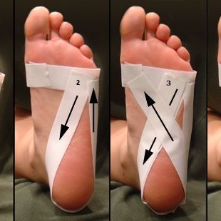 8135 Тейпирование