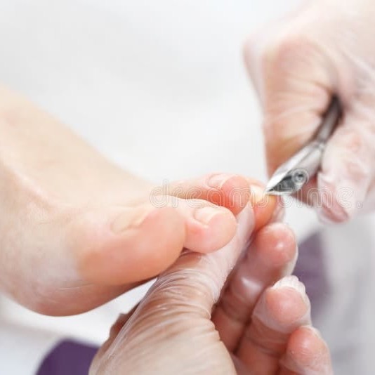 8140 Стрижка ногтей детская