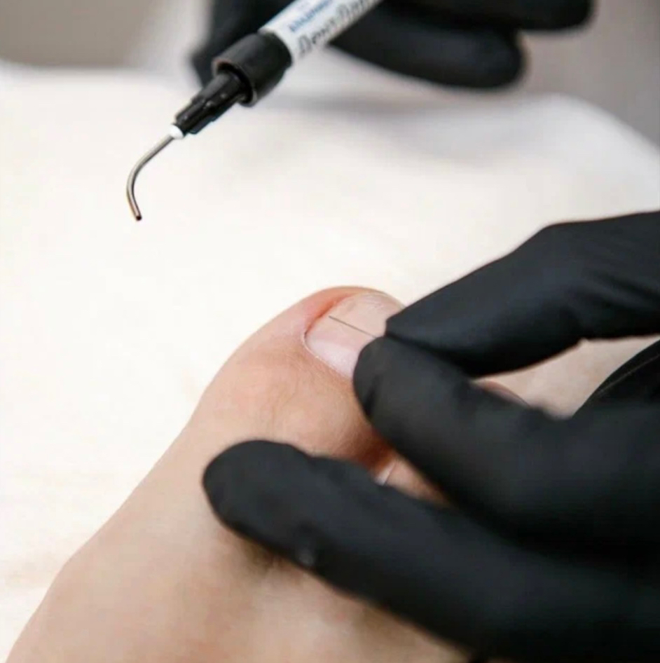 КС «титановая нить»